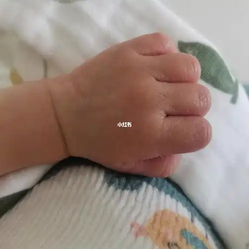 小手手合集_萌娃_萌娃_宝宝日常